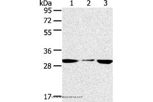 Western blot analysis of PC3 and hepg2 cell, human fetal liver tissue, using SDHB Polyclonal Antibody at dilution of 1:400 (SDHB antibody)