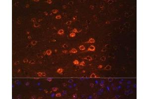 Immunofluorescence analysis of Mouse brain using NEFM Polyclonal Antibody at dilution of 1:100. (NEFM antibody)