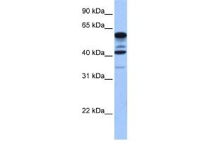 WB Suggested Anti-FAM46C Antibody Titration: 0. (FAM46C antibody  (Middle Region))