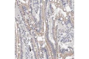 Immunohistochemical staining of human duodenum with NT5DC1 polyclonal antibody  shows moderate cytoplasmic positivity in glandular cells.