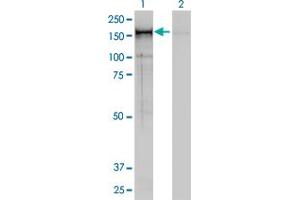 Western Blotting (WB) image for anti-Non-SMC Condensin I Complex, Subunit D2 (NCAPD2) (AA 1240-1339) antibody (ABIN599100)