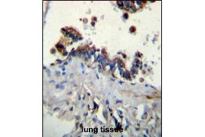 Immunohistochemistry (Paraffin-embedded Sections) (IHC (p)) image for anti-Ficolin (Collagen/fibrinogen Domain Containing) 3 (Hakata Antigen) (FCN3) (AA 214-243), (C-Term) antibody (ABIN656492)