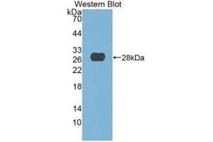 Detection of Recombinant DNASE1, Human using Monoclonal Antibody to Deoxyribonuclease I (DNASE1) (DNASE1 antibody  (AA 19-259))