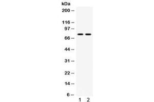 Western blot testing of 1) mouse testis and 2) human 22RV1 lysate with MDM4 antibody. (MDM4-binding Protein antibody)
