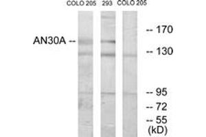 Western blot analysis of extracts from 293/COLO cells, using AN30A Antibody. (ANKRD30A antibody  (AA 1041-1090))