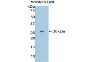 Western Blotting (WB) image for anti-Topoisomerase (DNA) II beta 180kDa (TOP2B) (AA 446-655) antibody (ABIN1860831) (TOP2B antibody  (AA 446-655))