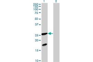 Western Blot analysis of FXN expression in transfected 293T cell line by FXN MaxPab polyclonal antibody.