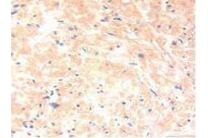IHC-P analysis of Human Prostate Gland Tissue, with DAB staining. (IL-13 antibody  (AA 25-146))