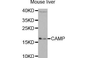 Western Blotting (WB) image for anti-Cathelicidin Antimicrobial Peptide (CAMP) (AA 31-170) antibody (ABIN6218724) (Cathelicidin antibody  (AA 31-170))