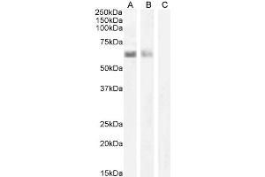 AIRE antibody  (C-Term)