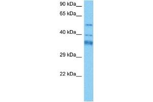 Host:  Mouse  Target Name:  GTF2H4  Sample Tissue:  Mouse Heart  Antibody Dilution:  1ug/ml (GTF2H4 antibody  (N-Term))