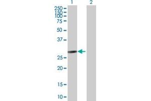 FANCA antibody  (AA 1-297)