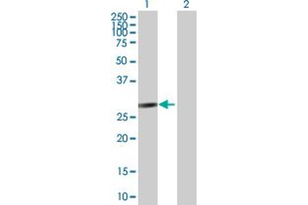 FANCA antibody  (AA 1-297)