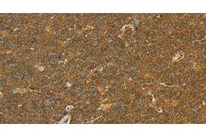 Immunohistochemistry (Paraffin-embedded Sections) (IHC (p)) image for anti-Apolipoprotein L, 2 (APOL2) antibody (ABIN7238534)