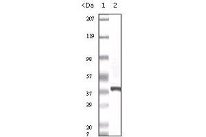 Western Blotting (WB) image for anti-S100 Calcium Binding Protein A6 (S100A6) (truncated) antibody (ABIN2464024)