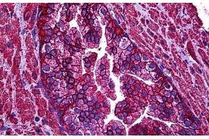 Human Prostate: Formalin-Fixed, Paraffin-Embedded (FFPE) (ABCC4 antibody  (AA 1-110))
