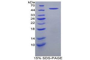 SDS-PAGE (SDS) image for Coagulation Factor IX (F9) (AA 1-146) protein (His tag,GST tag) (ABIN2122656) (Coagulation Factor IX Protein (F9) (AA 1-146) (His tag,GST tag))