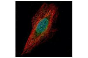 ICC/IF Image Confocal immunofluorescence analysis (Olympus FV10i) of paraformaldehyde-fixed HeLa, using Chk1, antibody (Green) at 1:500 dilution. (CHEK1 antibody  (C-Term))