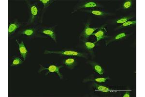 Immunofluorescence of purified MaxPab antibody to KIAA1967 on HeLa cell. (CCAR2 antibody  (AA 1-923))