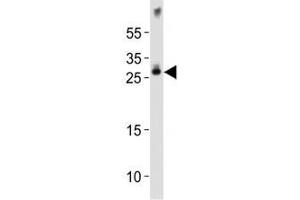 Western blot analysis of lysate from mouse brain tissue lysate using Olig1 antibody diluted at 1:1000. (OLIG1 antibody  (AA 161-194))