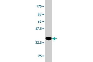 Western Blot detection against Immunogen (37. (Retinoic Acid Receptor alpha antibody  (AA 315-424))