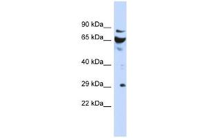 DCUN1D3 antibody used at 1 ug/ml to detect target protein. (DCUN1D3 antibody)