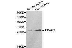 Western Blotting (WB) image for anti-Estrogen Receptor Binding Site Associated, Antigen, 9 (EBAG9) antibody (ABIN1872406) (RCAS1 antibody)