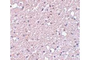 Immunohistochemistry (IHC) image for anti-Transmembrane Protein 184A (TMEM184A) (C-Term) antibody (ABIN1030750) (TMEM184A antibody  (C-Term))