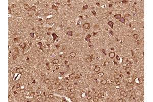 Paraformaldehyde-fixed, paraffin embedded mouse brain tissue, Antigen retrieval by boiling in sodium citrate buffer (pH6. (CAMK2B antibody  (AA 1-100))