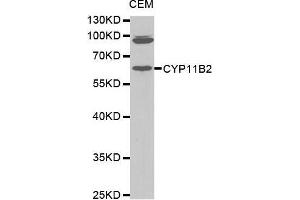 Western Blotting (WB) image for anti-Cytochrome P450, Family 11, Subfamily B, Polypeptide 2 (CYP11B2) (AA 234-503) antibody (ABIN1679468)