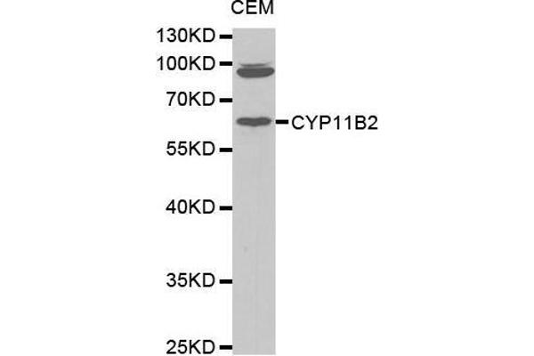 CYP11B2 Antikörper  (AA 234-503)