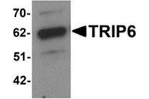 Western blot analysis of TRIP6 in EL4 cell lysate with TRIP6 antibody at 1 μg/ml. (TRIP6 antibody  (Center))
