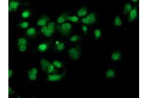 Anti-PDSS2 mouse monoclonal antibody (ABIN2455333) immunofluorescent staining of COS7 cells transiently transfected by pCMV6-ENTRY PDSS2 (RC207892). (PDSS2 antibody)