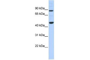 PPME1 antibody used at 1 ug/ml to detect target protein. (PPME1 antibody  (N-Term))
