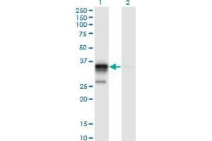 Western Blot analysis of ACOT8 expression in transfected 293T cell line by ACOT8 monoclonal antibody (M03), clone 3F1. (ACOT8 antibody  (AA 108-215))