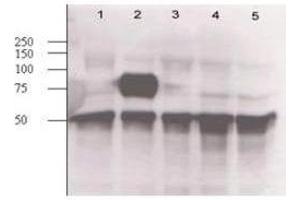 Rabbit anti-Ang-2 was used at a 1:500 dilution to detect mouse Ang-2 in supernatants of mouse-angiopoietin-expressing endothelial cells. (Angiopoietin 2 antibody  (N-Term))