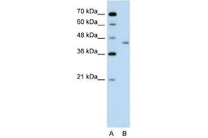 LRP2BP antibody used at 1 ug/ml to detect target protein. (LRP2BP antibody  (Middle Region))