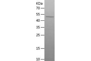 ERRFI1 Protein (AA 224-462) (His-IF2DI Tag)
