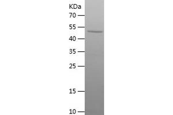 ERRFI1 Protein (AA 224-462) (His-IF2DI Tag)