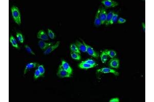 Immunofluorescent analysis of HepG2 cells using ABIN7173199 at dilution of 1:100 and Alexa Fluor 488-congugated AffiniPure Goat Anti-Rabbit IgG(H+L) (TMEM31 antibody  (AA 1-118))