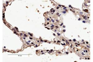 ABIN190832 (4µg/ml) staining of paraffin embedded Human Lung. (HRH1 antibody  (Internal Region))