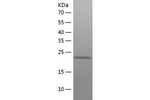 Western Blotting (WB) image for Malectin (MLEC) (AA 29-269) protein (His tag) (ABIN7287181) (Malectin Protein (MLEC) (AA 29-269) (His tag))