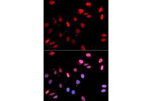 Immunofluorescence analysis of U2OS cells using Rad18 antibody (ABIN6128609, ABIN6146628, ABIN6146630 and ABIN6217430). (RAD18 antibody  (AA 216-495))