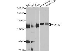 Western blot analysis of extracts of various cell lines, using NUP155 Antibody (ABIN5975637) at 1/1000 dilution. (NUP155 antibody)