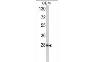 Western blot analysis of PRDX6 Antibody (C-term) (ABIN389471 and ABIN2839535) in CEM cell line lysates (35 μg/lane). (Peroxiredoxin 6 antibody  (C-Term))