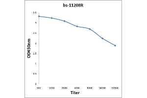 Antigen: 2 µg/100 µL  Primary: Antiserum, 1:500, 1:1000, 1:2000, 1:4000, 1:8000, 1:16000, 1:32000;  Secondary: HRP conjugated Rabbit Anti-Goat IgG at 1: 5000;  TMB staining Read the data in Microplate Reader by 450nm. (SOX4 antibody  (AA 54-103))