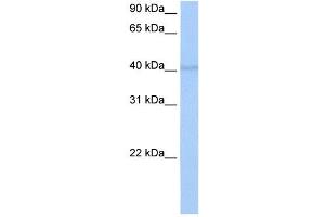 RBM4 antibody used at 0. (RBM4 antibody  (C-Term))
