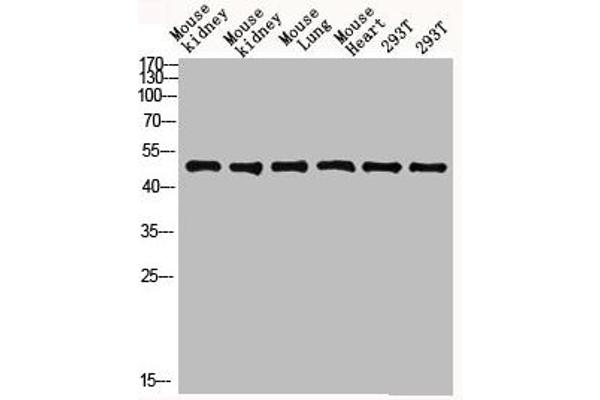 FCGR1A antibody  (AA 230-280)