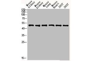 Western blot analysis of mouse-kidney lysate, antibody was diluted at 2000. (FCGR1A antibody  (AA 230-280))