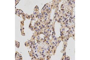 Immunohistochemistry (IHC) image for anti-Neuropilin 2 (NRP2) (AA 150-420) antibody (ABIN6219689) (NRP2 antibody  (AA 150-420))